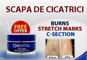 Scapa de Cicatrici.